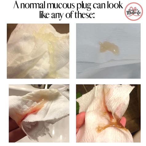 can the mucus plug come out in bits|mucus plug discharge.